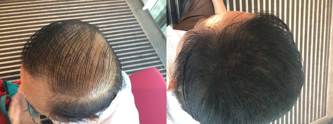 saiful guna petua rambut lebat serat topik